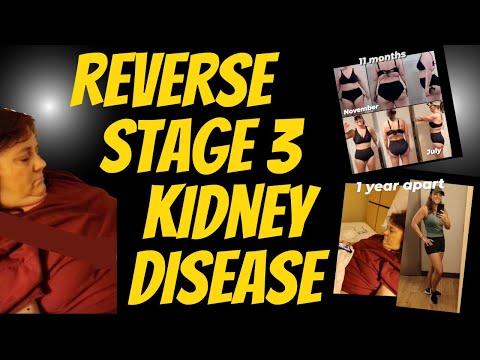 How a Carnivore Diet Helped Reverse Kidney Disease: Amy's Inspiring Journey