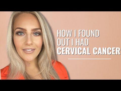 Cervical Cancer Journey: From Misdiagnosis to Treatment - Cara's Story